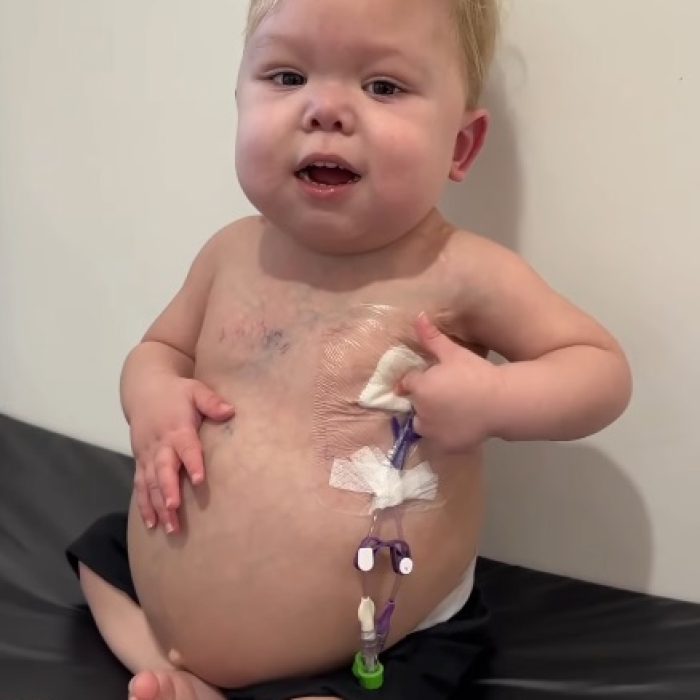 kaleb-catheter-care